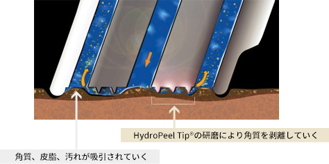 Step 2：マイルドなピーリング